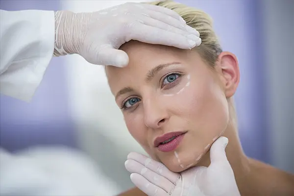 foto Bioestimuladores de Colágeno