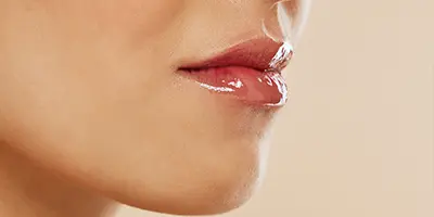 foto-preenchimento-labial